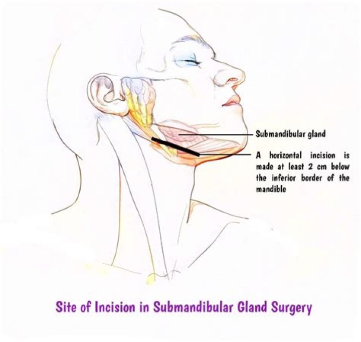 Is mandibular upper or lower?