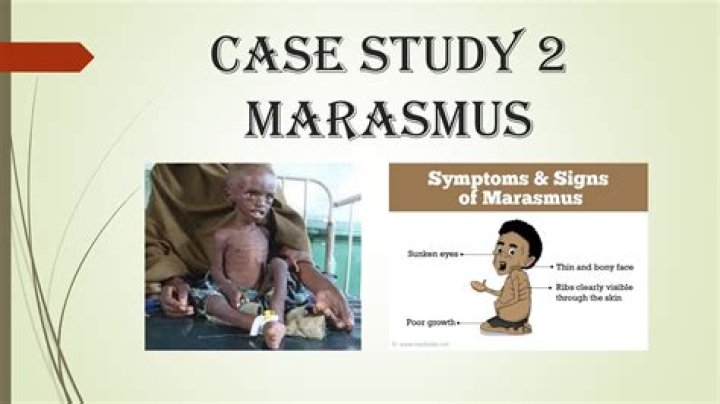 Is marasmus a deficiency disease?