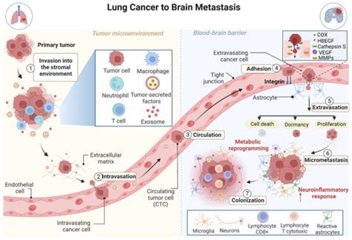 Is metastases a verb?