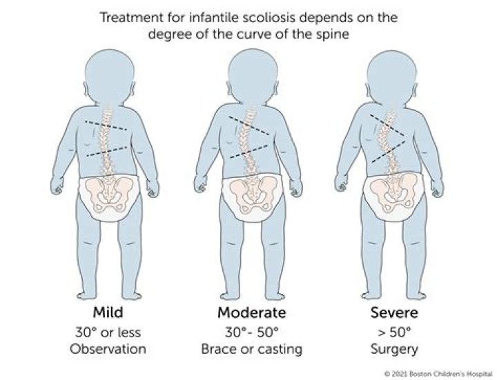 Is my baby having retractions?