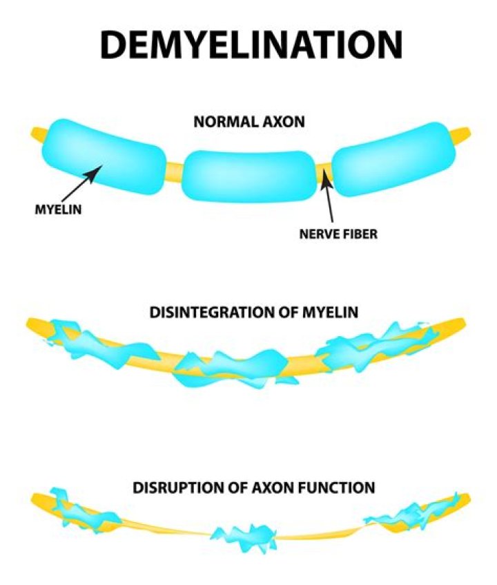 Is myelination a noun?