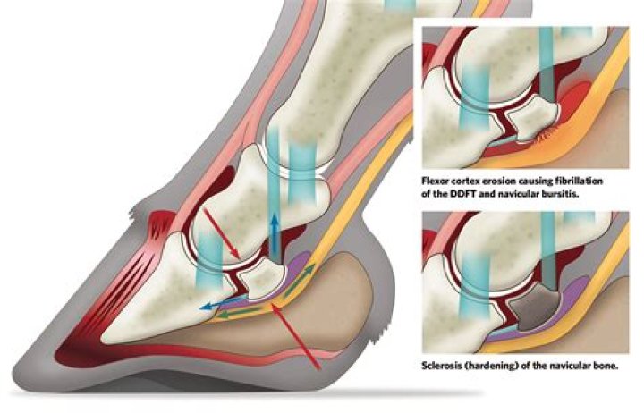 Is navicular painful in horses?
