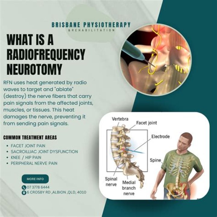 Is neurotomy a word?
