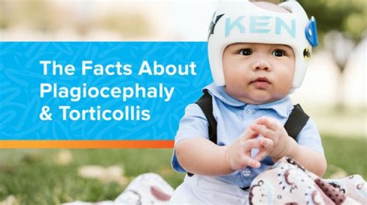Is plagiocephaly covered by insurance?