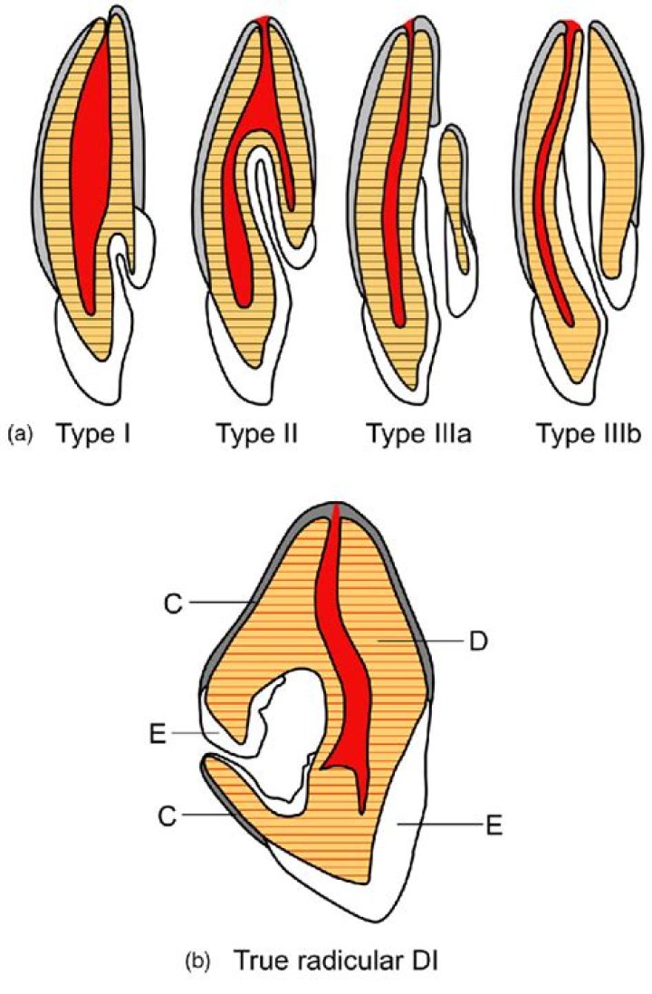 Is radicular a word?