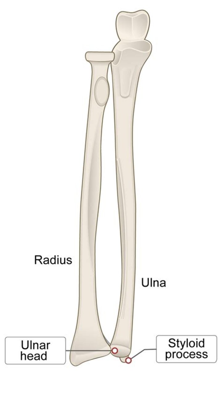 Is radius worth it?