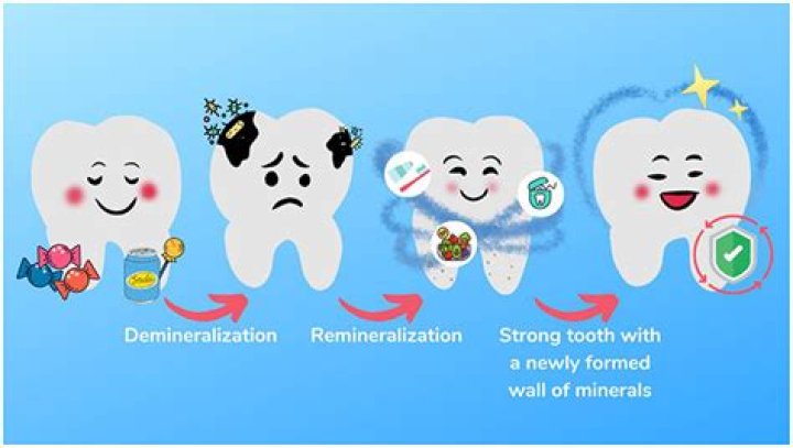 Is remineralization toothpaste safe?