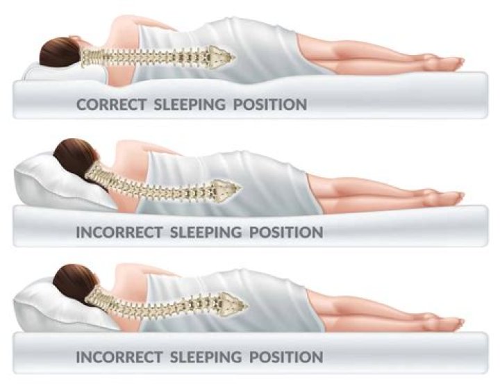 Is side sleeping bad for posture?