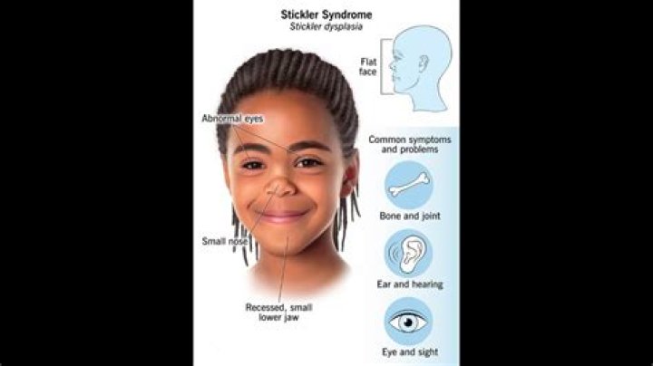 Is stickler syndrome a disability?