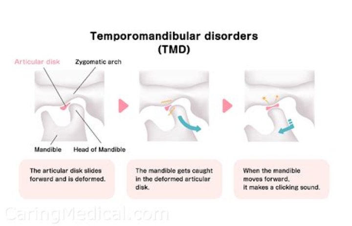Is temporomandibular joint dysfunction dangerous?