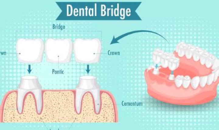 Is the an ada code for sectioning a bridge?