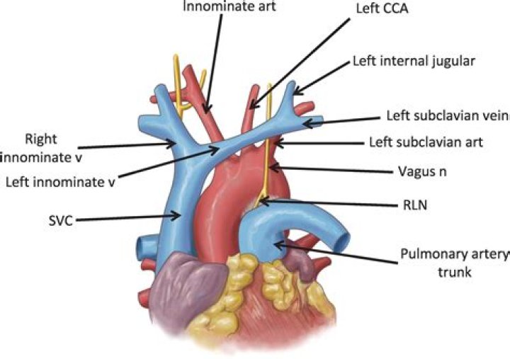 Is there a left innominate artery?