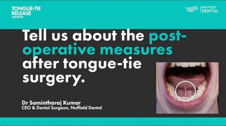 Is tongue tie surgery painful?