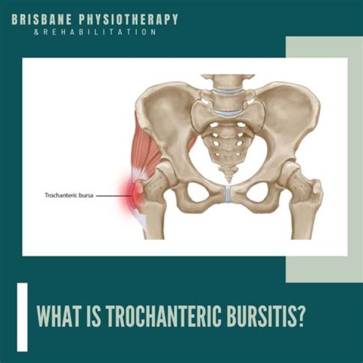 Is trochanteric bursitis dangerous?