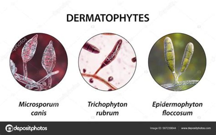 Is yeast a dermatophyte?