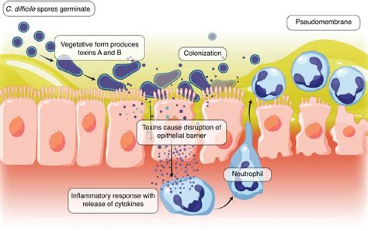 On the mucosal surface?