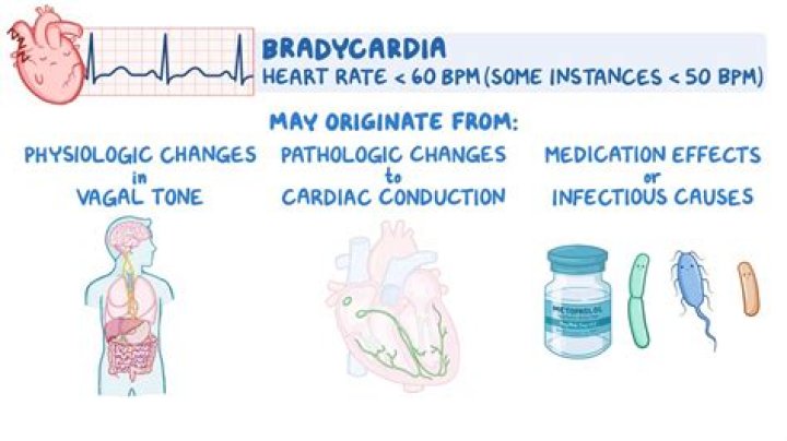 Should bradycardia be treated?