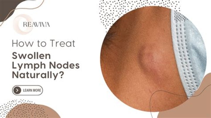 Should enlarged lymph nodes hurt?