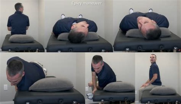 Should epley maneuver be repeated?