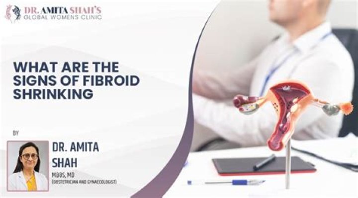 Should fibroids be treated?