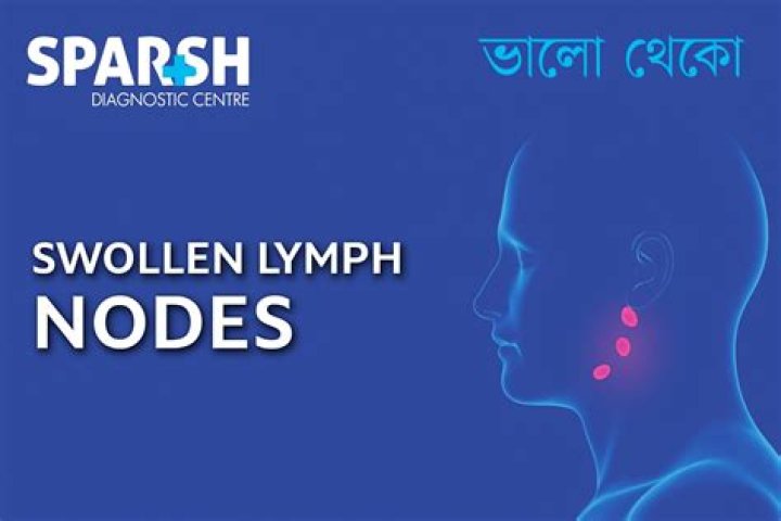 Should i go to the doctor for swollen lymph nodes?