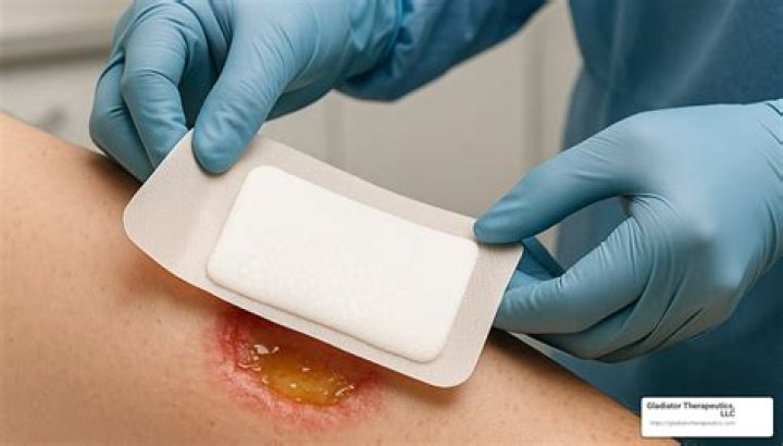 Should i put band aid on my wound?