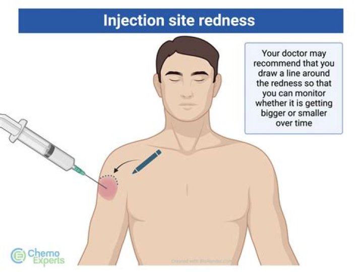 Should injection site bleed?
