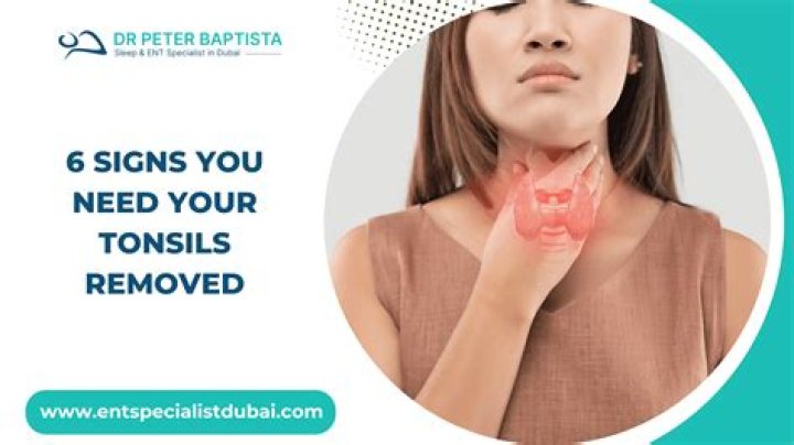 Should sunspots be removed?