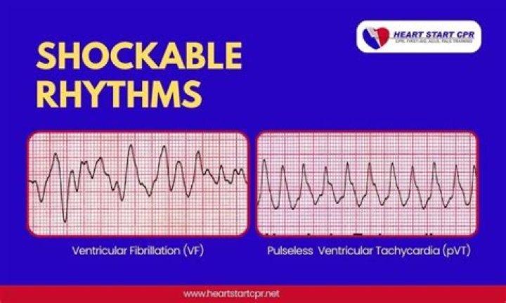 Should there be a rhythm to parallel construction?