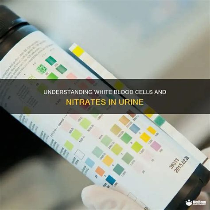 Should there be nitrates in urine?