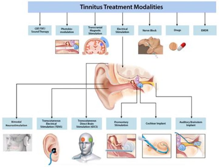 Should tinnitus be painful?