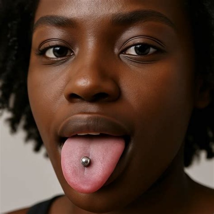 Should tongue be white?