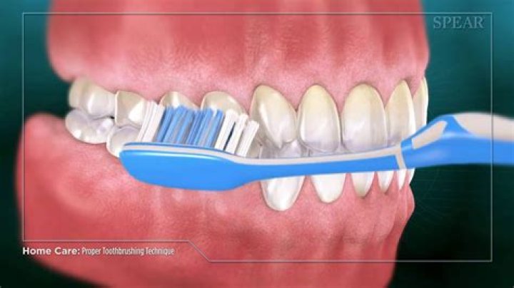 Should toothbrush touch gums?