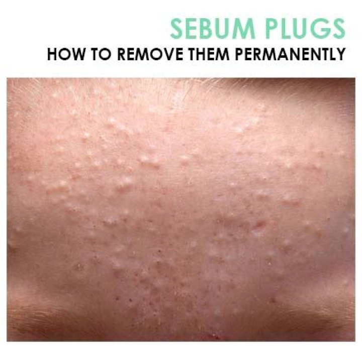 Should you remove sebum from pores?