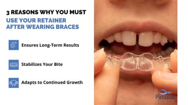 Should you wear old retainers?