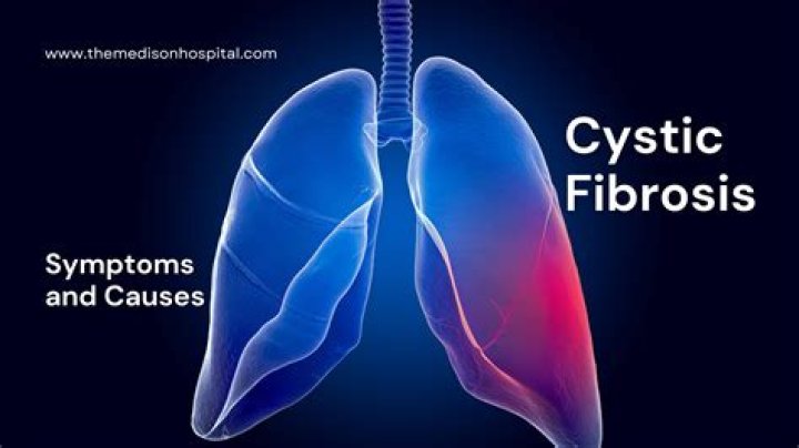 Was causes cystic fibrosis?