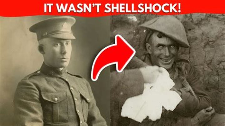 Was is shell shock?