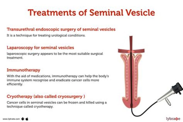 Was ist seminal vesicle?