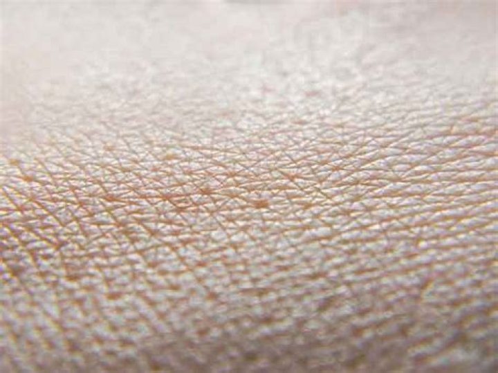 Was ist stratum corneum?