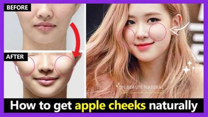 What are apple cheeks?