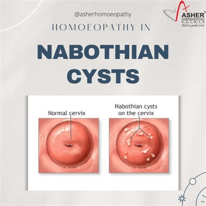 What are nabothian cysts?