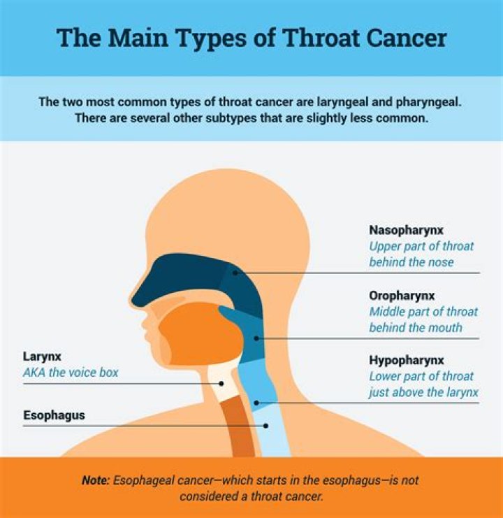 What are the early stages of throat cancer?