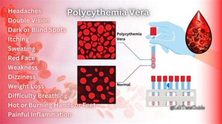 What are the symptoms of polycythaemia?