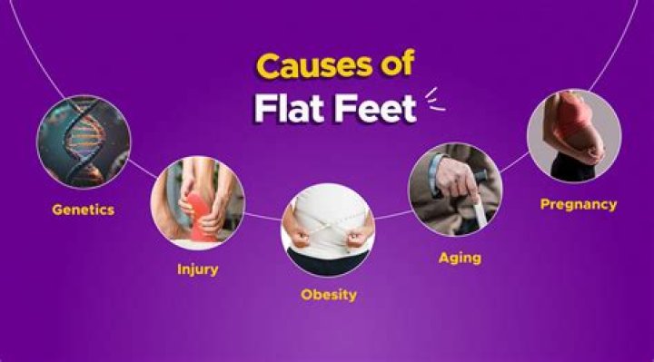 What can cause flat feet?