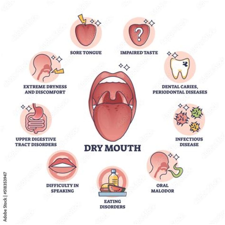 What causes dry mouth?