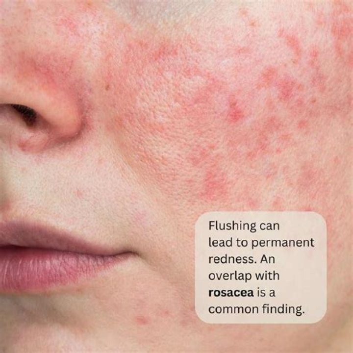 What causes flushness in the face?