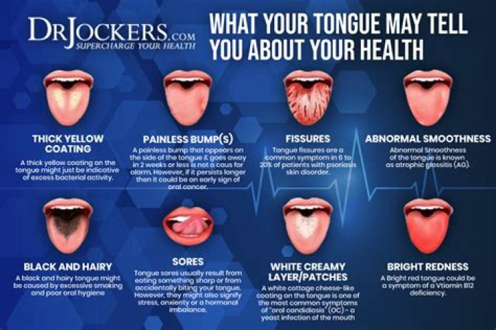 What causes half your tongue to swell?