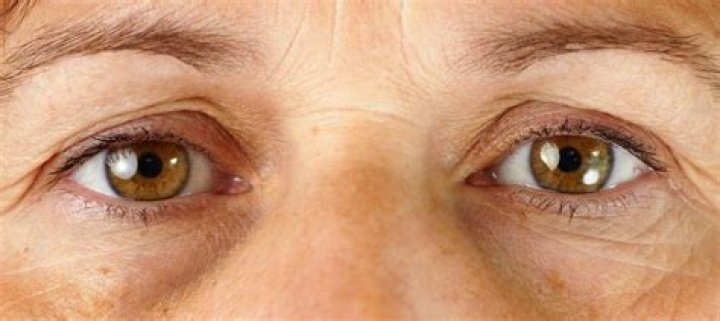 What causes old looking eyes?