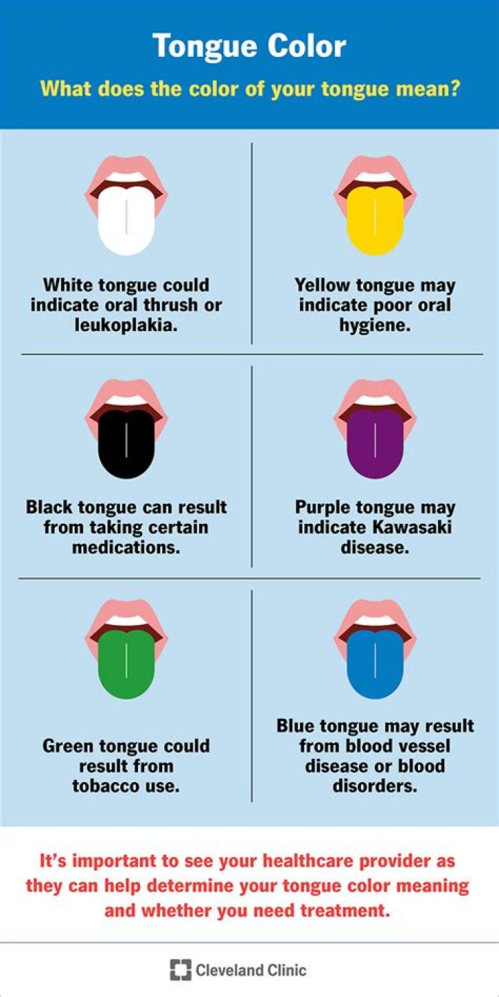 What causes towels to discolor?