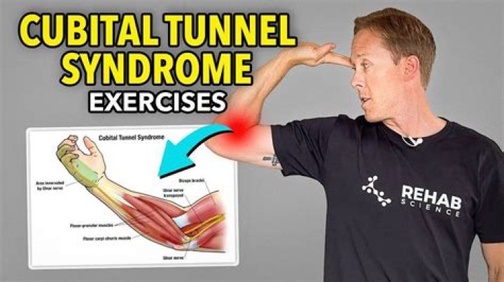 What cubital tunnel syndrome?